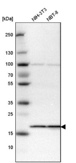 SSR3 Antibody, Novus Biologicals 0.1mL; Unlabeled:Antibodies, Polyclonal